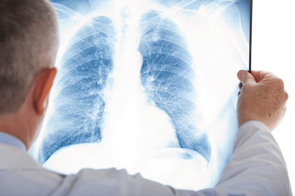 How to become a radiographer UK-based